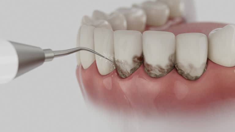 Reliable Dental Implants contractor in Hammond, WI by Smile Center Dentistry